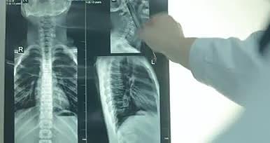 人民医院讲解骨格骨科视频视频的预览图
